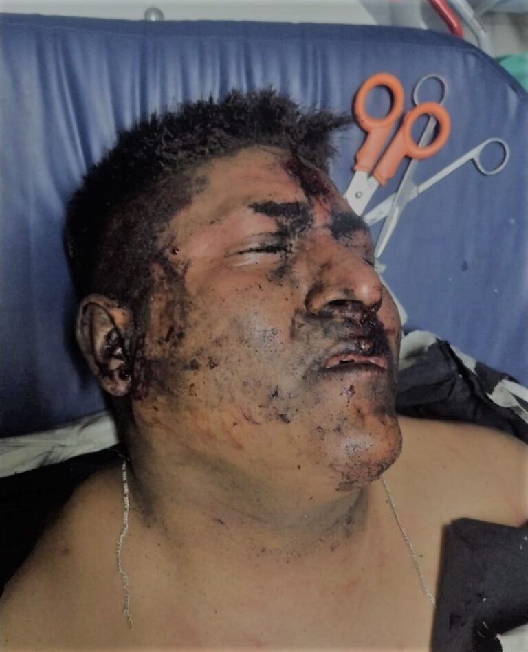 Atentado con auto-bomba en Celaya deja cuatro guardias nacionales lesionados de gravedad