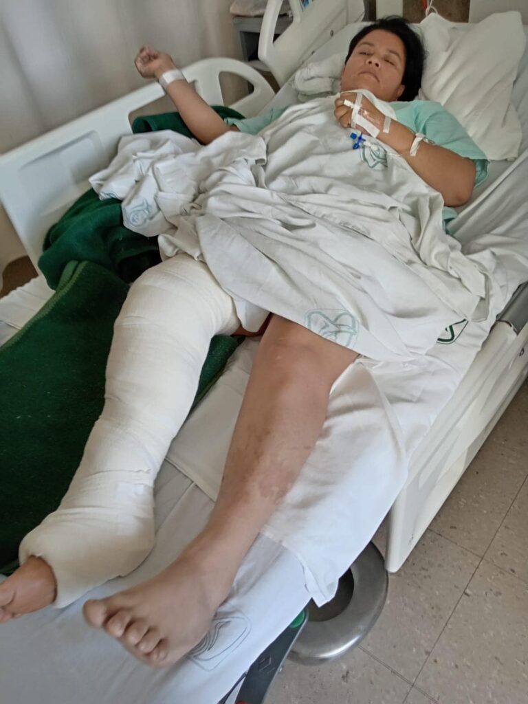 Mujer es atropellada, no obstante, la Fiscalía la pone como imputada