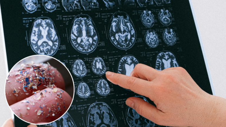 Directo al cerebro, ahí se acumulan los microplásticos